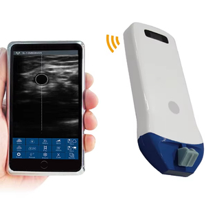 5P UHF 리니어 팜 도플러 초음파 초고주파, 무선 프로브 타입 컬러 도플러 초음파 스캐너, 128 요소 - Product Image 1