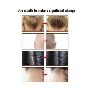 Acondicionador Suavizante e Hidratante con Biotina OEM ODM, Acondicionador Anticaída y para el Crecimiento del Cabello para Uso Diario - Product Image 5