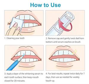Bolígrafos Blanqueadores de Dientes Naturales con Logotipo Privado, Fáciles de Usar y que Dejan los Dientes Brillantes - Product Image 5