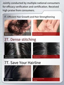 Tratamiento Capilar Avanzado con ADN para Hidratar, Calmar y Fortalecer el Cuero Cabelludo, Sérum para el Cuidado del Cabello <span class=keywords><strong>Yogoo</strong></span>, Venta al Por Mayor - Product Image 4