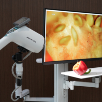 Colposcope vidéo numérique haute définition Kernel GN-500 pour le dépistage de la néoplasie cervicale et l'évaluation clinique gynécologique