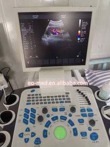Mesin Diagnostik Ultrasound Doppler Warna Portabel Medis Multifungsi, Mesin Diagnostik Ultrasound Echo Ultrasonido Portatil TC29 - Product Image 4