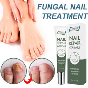 Trattamento per Unghie Fungine OEM, Facile da Usare, Leggero, Delicato sulla Pelle, Crema Riparatrice per Unghie per Rimuovere i Funghi dai Piedi - Product Image 5