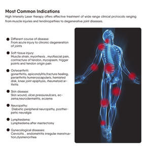 Appareil de physiothérapie <span class=keywords><strong>Laser</strong></span> à haute puissance 30w classe 4, soulagement de la douleur, équipement de physiothérapie à <span class=keywords><strong>Laser</strong></span> froid - Product Image 6