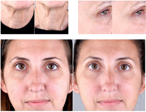 Favorise l'absorption de la crème pour le visage, réduit les rides, 850nm, thérapie infrarouge, masseur facial, raffermissement de la peau, lumière rouge, anti-âge - Product Image 6