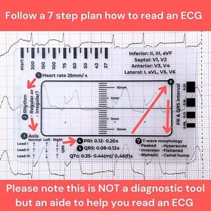 Regla de 7 Pasos para ECG, Regla de ECG para Interpretación, Herramienta de Medición de Plástico, Calibrador Transparente para EKG, Referencia de Enfermería - Product Image 2