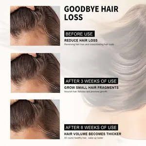 Marque privée personnalisée 100% sérum de soin du cuir chevelu biologique naturel huile essentielle de traitement des cheveux au romarin pour les femmes - Product Image 5