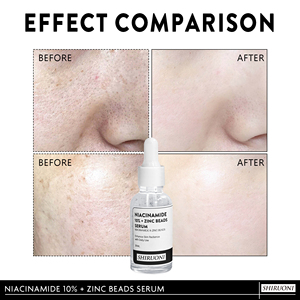 Marque privée Hydratant pour le visage Blanchiment <span class=keywords><strong>de</strong></span> la <span class=keywords><strong>peau</strong></span> Hydrate en profondeur Éclaircit le sérum pour le visage à la niacinamide et aux <span class=keywords><strong>perles</strong></span> <span class=keywords><strong>de</strong></span> zinc - Product Image 6