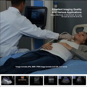 Échographie gynécologique d'ordinateur portable cardiaque d'échocardiographie médicale - Product Image 4
