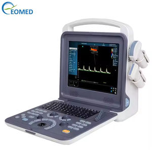 पोर्टेबल रंग डॉपलर नैदानिक अल्ट्रासाउंड स्कैनर चिकित्सा अल्ट्रासाउंड मशीन क्यू28 - Product Image 3