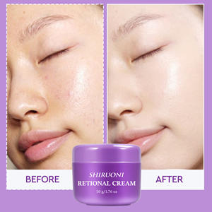 Crema hidratante facial de etiqueta privada, reducción de arrugas, refinación de poros, crema hidratante blanqueadora <span class=keywords><strong>Retional</strong></span> - Product Image 5