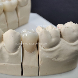 OEM/ODM servizi di laboratorio odontoiatrico perfetto aspetto belle corone in ceramica di <span class=keywords><strong>Zirconia</strong></span> con gomma realistica in Cina laboratorio odontoiatrico - Product Image 5