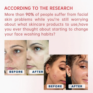 Toallitas Faciales Desechables de Tela No Tejida WIPEX, Toallitas Faciales Suaves y Secas para Limpiar el Rostro y Desmaquillar - Product Image 6