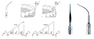 Embout de travail de l'instrument DS-011A EMS P pour l'élimination précise des calculs et des concrétions sous-gingivaux et supragingivaux tenaces - Product Image 3