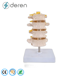 Modello di Colonna Vertebrale Flessibile di Alta Qualità con Pelvi e Teste Femurali <span class=keywords><strong>Mobili</strong></span> per Dimostrazioni di Fisioterapia - Product Image 4
