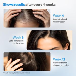 Siero Roll-on Premium Biologico per la Crescita dei Capelli 25ml con 5% Saw Palmetto, 3% Rosmarino, 1% Caffeina, Estratti Erboristici e 3% Fieno Greco - Product Image 6
