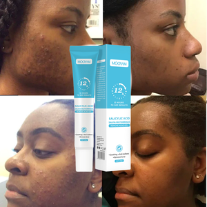 Gel para el Acné de Marca Privada OEM con Ácido Salicílico y Salvia Miltiorrhiza, Elimina el Acné, Disuelve la Capa Cutánea, Desobstruye los Poros, Limpieza Profunda, Gel para el Acné MOOYAM - Product Image 2