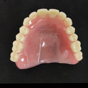 Marco de metal completo <span class=keywords><strong>superior</strong></span> e inferior con <span class=keywords><strong>dentadura</strong></span> <span class=keywords><strong>parcial</strong></span> acrílica extraíble - Product Image 5