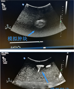 Modèle de sein en silicone pour biopsie à l'aiguille guidée par échographie - Modèle d'enseignement et de formation médicale - Product Image 6