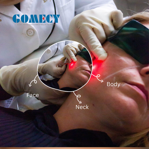 Máquina de Endolifting de Alta Potencia 30W 3000ms con Ancho de Pulso de 980nm y 1470nm - <span class=keywords><strong>Precio</strong></span> - Product Image 2