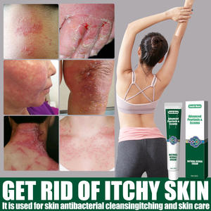 Limpiador <span class=keywords><strong>Facial</strong></span> Herbal con Licencia para el Cuidado de la Piel, para Psoriasis, <span class=keywords><strong>Dermatitis</strong></span>, Eccema, Picazón, Ungüento y Crema para Psoriasis - Product Image 6