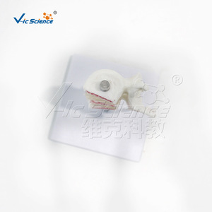 Modèle anatomique de colonne lombaire malade, modèle d'ostéoporose VIC-L034, ostéoporose de fémur humain. - Product Image 2