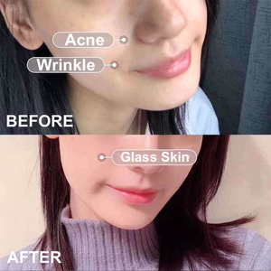 Korean Emergency Care Skin Care Booster Facial Essence Salmon Dna Pdrn Serum Sensitive Oily Skin Oil Control for <strong>T</strong> <strong>Zone</strong> Set - Product Image 3