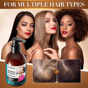 Shampoo <span class=keywords><strong>anti</strong></span>-frisottis de haute qualité 300 ml - Mousse nettoyante antipelliculaire <span class=keywords><strong>anti</strong></span>-chute de cheveux - Product Image 3