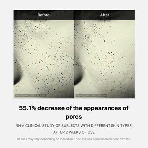 Medicube Zero Pore Tek Günlük Krem Gözle Görülebilir Şekilde Daha Küçük Gözenekler Sağlar, Asit İçeren Gözenek Sıkılaştırıcı Krem ve Kore Cilt Bakımı - Product Image 3