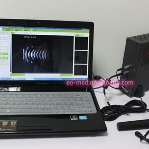 Escáner de Ultrasonido LED Oftálmico A/B EUS500T, Precio de Fábrica, para Pruebas de Biometría Ocular en Oftalmología - Product Image 2