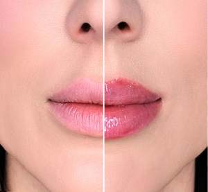 Gel de soin des lèvres populaire Vitamine C lèvre repulpante marque privée - Product Image 4