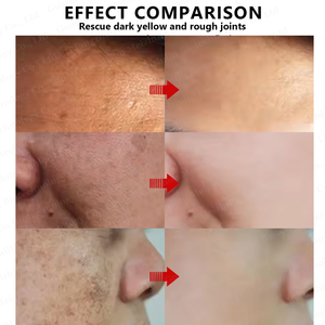 Krim Esens pengencang kolagen peptida, Krim Wajah <span class=keywords><strong>Anti</strong></span> Penuaan untuk wanita Afrika - Product Image 6