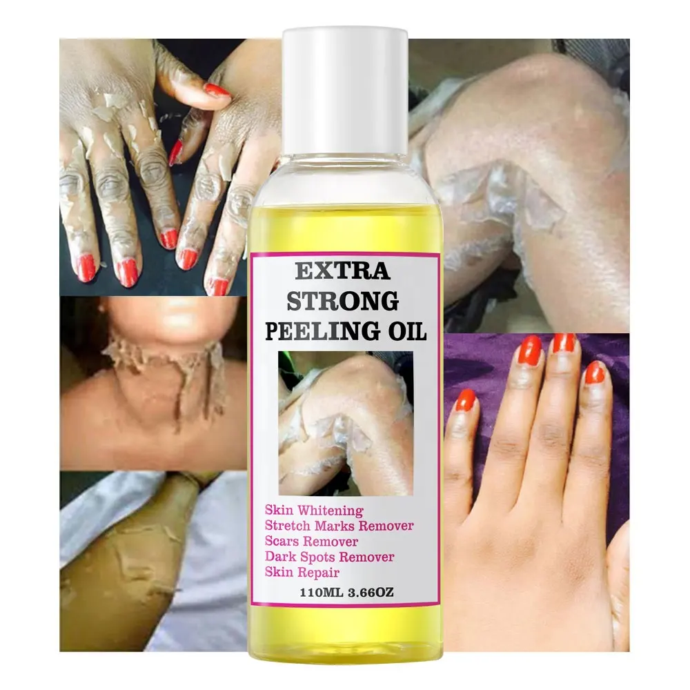 Private Label Extra Strength Yellow Peeling Oil Knuckles Skin Whitening Remove Dead Skin Exfoliating Anti Dark Spots Oil