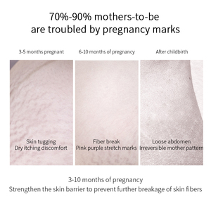 <span class=keywords><strong>Aceite</strong></span> DE PREVENCIÓN DE ESTRÍAS Natural orgánico vegano cuidado de la piel regenerar reparación de <span class=keywords><strong>cicatrices</strong></span> <span class=keywords><strong>aceite</strong></span> corporal para estrías - Product Image 4