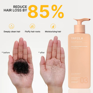 Set Professionale Personalizzato per Salone: Shampoo e Balsamo al Rosmarino con Cheratina Idrolizzata Naturale Antiforfora per la Cura dei Capelli con il Mio Logo - Product Image 5