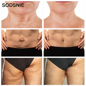 SODSNIE <span class=keywords><strong>Crema</strong></span> Corpo al Retinolo Anti-Età 50g, <span class=keywords><strong>Crema</strong></span> Naturale Rassodante e Anti-Rughe per il Corpo - Product Image 2