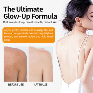 Service de soins de la peau personnalisés pour rehausser l'éclat naturel de la peau, spray exfoliant à l'acide kojique et au curcuma - Product Image 2