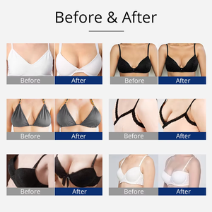 USA Stock Butt Vakuum therapie Maschine Brust straffung Vergrößerung mit Buttok Cups - Product Image 5