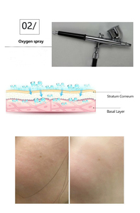 Máquina de Hidrodermoabrasión Profesional con Chorro de Oxígeno para Rejuvenecimiento de la Piel, Eliminación de Cicatrices de Acné y Arrugas - Product Image 6