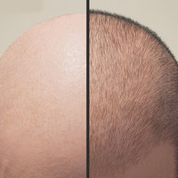 Huile de traitement capillaire à base de plantes Perfect Effect pour la repousse des cheveux chez les hommes avec extrait de plantes naturelles 50ml