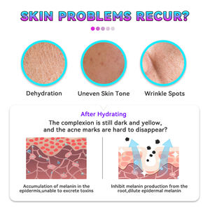 <span class=keywords><strong>DR</strong></span>.ROSEVA Snail Mucin Serum wajah, Anti Penuaan perawatan kulit perbaikan pemutih wajah untuk kulit sensitif pasokan OEM - Product Image 6