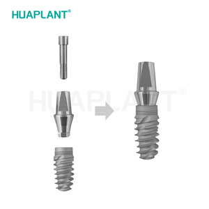 نماذج زرع الأسنان ثلاثية الأبعاد قابلة للتخصيص وملحقاتها، نماذج توضيحية للزرع، أدوات تعليمية لأطباء الأسنان - Product Image 4