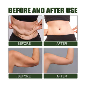 Offre Spéciale la texture et le teint de la peau Améliorant les niveaux de collagène revigorant Exfoliant pour le corps - Product Image 4