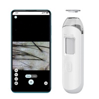 Analyseur et détecteur de follicule pileux à usage domestique Analyseur de peau USB Android Phone Tablet Compatible Scalp Testing Tool