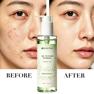 Limpiador Facial Diario Hidratante con pH Orgánico ODM/OEM, Gel Espumoso Limpiador Profundo de Poros, Crema Gel que se Convierte en Espuma - Product Image 1