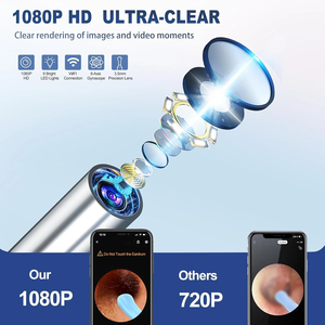 Wireless Otoscope <strong>Ear</strong> Wax Removal Earwax Removal Kit 1080P HD <strong>Ear</strong> <strong>Cleaner</strong> <strong>with</strong> <strong>Camera</strong> - Product Image 3