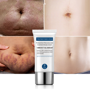 Coccodrillo Smagliature Crema di Rimozione Ance Di Maternità Riparazione Anti Invecchiamento Chiocciole Rassodante Cura Del Corpo Gravidanza Cicatrici - Product Image 3