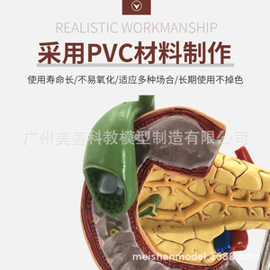 Modèle de simulation pédagogique des tissus pathologiques du pancréas, de la rate, du foie, de la vésicule biliaire et du duodénum ; spécimen pathologique du pancréas - Product Image 3