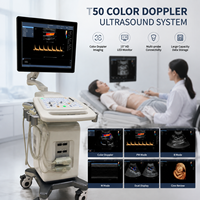 Sistema de Ultrasonido Doppler Color, Equipo de Diagnóstico Médico, Monitor HD de 15 Pulgadas, Modo B, Modo M, Máquina de Imágenes Doppler Color PW