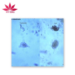 Parasiten Rutschen Set Zysten von Giardia lamblia W. <span class=keywords><strong>M</strong></span>. (trophozoites) - Product Image 1